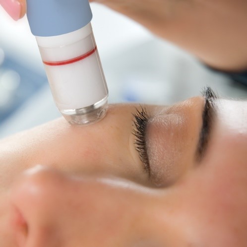 Experience the Nourishing Benefits Of Hydrodermabrasion